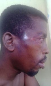 Some of the injuries received by RC Paul Waterman